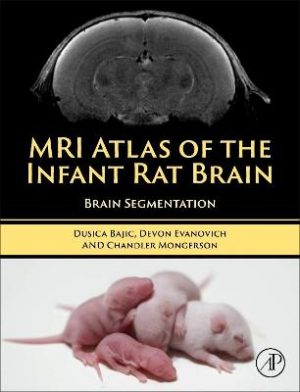 MRI Atlas of the Infant Rat Brain: Brain Segmentation